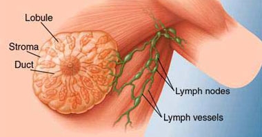 تقرير يحذر: عدم تطوير أبحاث سرطان الثدى يهدد بوفاة 180 ألف امرأة سنويا