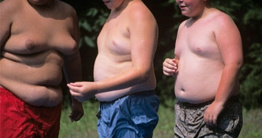 السمنة ترفع خطر الإصابة بأمراض الأمعاء الالتهابية