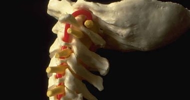 استشارى جراحة: علاج آلام انزلاق الفقرات دون اللجوء للعمليات ممكن 