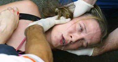 فوكس نيوز: جراحات الصرع ترضى المرضى بعد عودتهم للحياة الطبيعية 