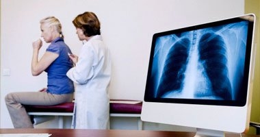 تعرف على أسباب وأعراض مرض العملقة 