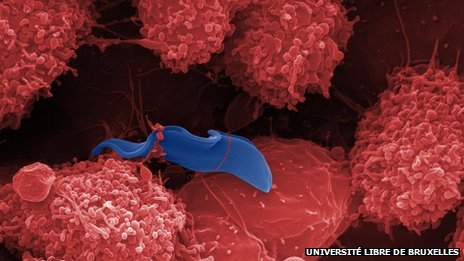  دراسة: خطوات أولى للتوصل لعلاج مرض النوم