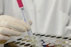 السعودية تعلن عن حالتي وفاة جديدتين بفيروس 