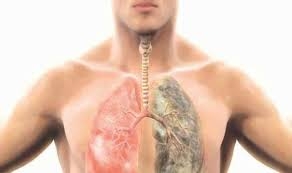 أساتذة الصدر والشعب الهوائية فى مؤتمرين يؤكدون: التلوث والتدخين أهم مسببات تليف الرئة والسدة الرئوية المزمنة