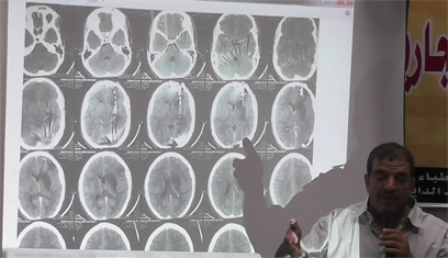 مؤتمر صحفي حول الاعتداء علي الاطباء والمستشفيات في الاحداث الجارية 30-7-2013 