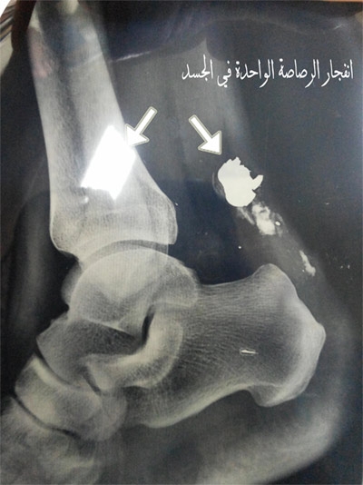 مؤتمر صحفي حول الاعتداء علي الاطباء والمستشفيات في الاحداث الجارية 30-7-2013 