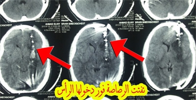 مؤتمر صحفي حول الاعتداء علي الاطباء والمستشفيات في الاحداث الجارية 30-7-2013 