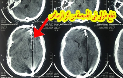مؤتمر صحفي حول الاعتداء علي الاطباء والمستشفيات في الاحداث الجارية 30-7-2013 